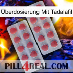 Überdosierung Mit Tadalafil 19
